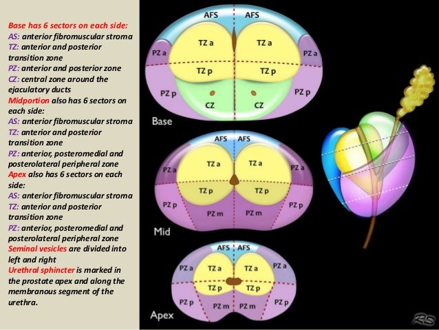 Presentation1 Mri Imaging Of The Prostate Presentation1 Mri Imaging Of The Prostate