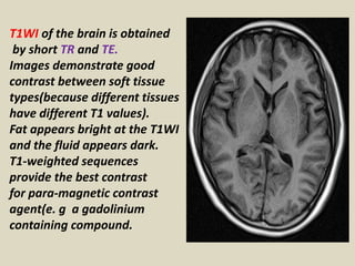 T1WI of the brain is obtained
by short TR and TE.
Images demonstrate good
contrast between soft tissue
types(because different tissues
have different T1 values).
Fat appears bright at the T1WI
and the fluid appears dark.
T1-weighted sequences
provide the best contrast
for para-magnetic contrast
agent(e. g a gadolinium
containing compound.
 