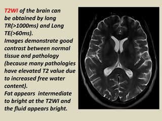 T2WI of the brain can
be obtained by long
TR(>1000ms) and Long
TE(>60ms).
Images demonstrate good
contrast between normal
tissue and pathology
(because many pathologies
have elevated T2 value due
to increased free water
content).
Fat appears intermediate
to bright at the T2WI and
the fluid appears bright.
 