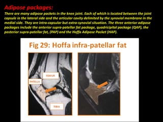 Adipose packages:
There are many adipose packets in the knee joint. Each of which is located between the joint
capsule in the lateral side and the articular cavity delimited by the synovial membrane in the
medial side. They are intra-capsular but extra-synovial situation. The three anterior adipose
packages include the anterior supra-patellar fat package, quadricipital package (QAP), the
posterior supra-patellar fat, (PAP) and the Hoffa Adipose Packet (HAP).
 