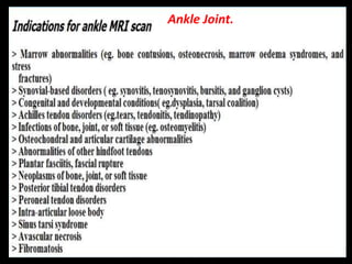 Ankle Joint.
 