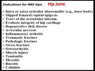 Hip Joint.
 
