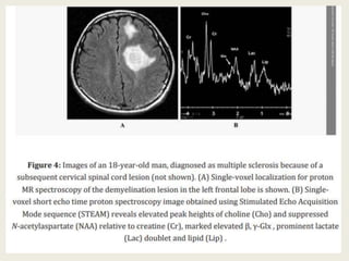 Presentation1, new mri techniques in the diagnosis and monitoring of ...