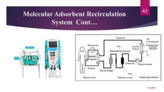 Molecular Adsorbent Recirculation
System Cont…
7/15/2023
43
 