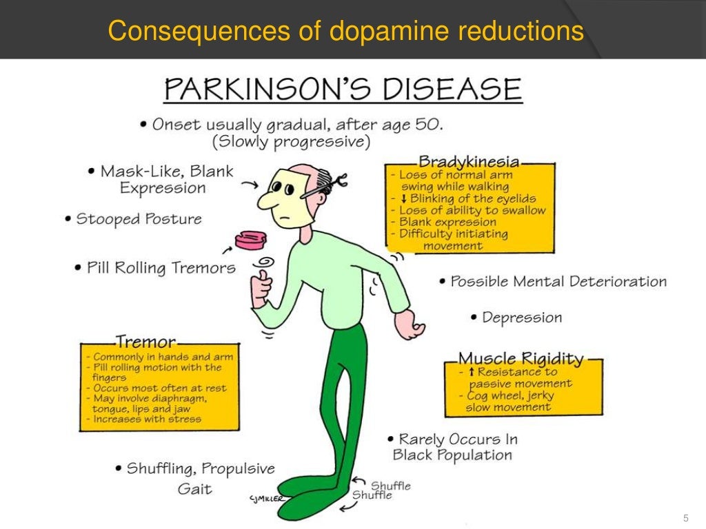 Presentation parkinson