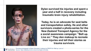 1
Dylan survived his injuries and spent a
year and a half in recovery including
traumatic brain injury rehabilitation.
Today, he is an advocate for seat belts
and transportation safety. He and other
survivors created a photo-series for the
New Zealand Transport Agency for the
a social awareness campaign: “Belt up.
Live on.” They don makeup to recreate
their injuries and tell their stories as
trauma survivors.
The above photograph is Dylan Chirnside in makeup by PROFX for “Belt up. Live on.”
Source: https://beltedsurvivors.nz/survivor/dylan-chirnside
 