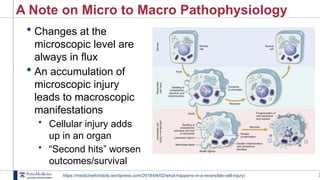 2
A Note on Micro to Macro Pathophysiology
 Changes at the
microscopic level are
always in flux
 An accumulation of
microscopic injury
leads to macroscopic
manifestations
• Cellular injury adds
up in an organ
• “Second hits” worsen
outcomes/survival
https://medicineforidiots.wordpress.com/2018/04/02/what-happens-in-a-reversible-cell-injury/
 