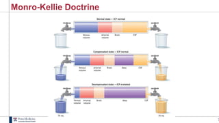 3
Monro-Kellie Doctrine
 