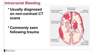4
Intracranial Bleeding
Usually diagnosed
on non-contrast CT
scans
Commonly seen
following trauma
 