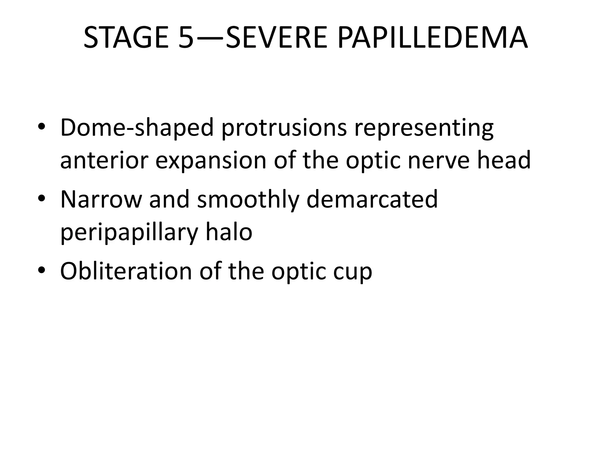 STAGE 5—SEVERE PAPILLEDEMA
• Dome-shaped protrusions representing
anterior expansion of the optic nerve head
• Narrow and smoothly demarcated
peripapillary halo
• Obliteration of the optic cup
 
