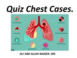 Quiz Chest Cases.
Dr/ ABD ALLAH NAZEER. MD.
 