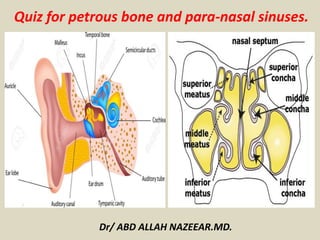 Quiz for petrous bone and para-nasal sinuses.
Dr/ ABD ALLAH NAZEEAR.MD.
 