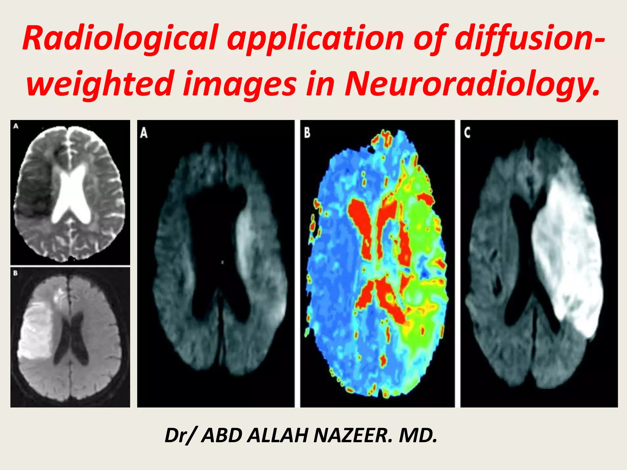 Presentation1, radiological application of diffusion weighted imges in ...