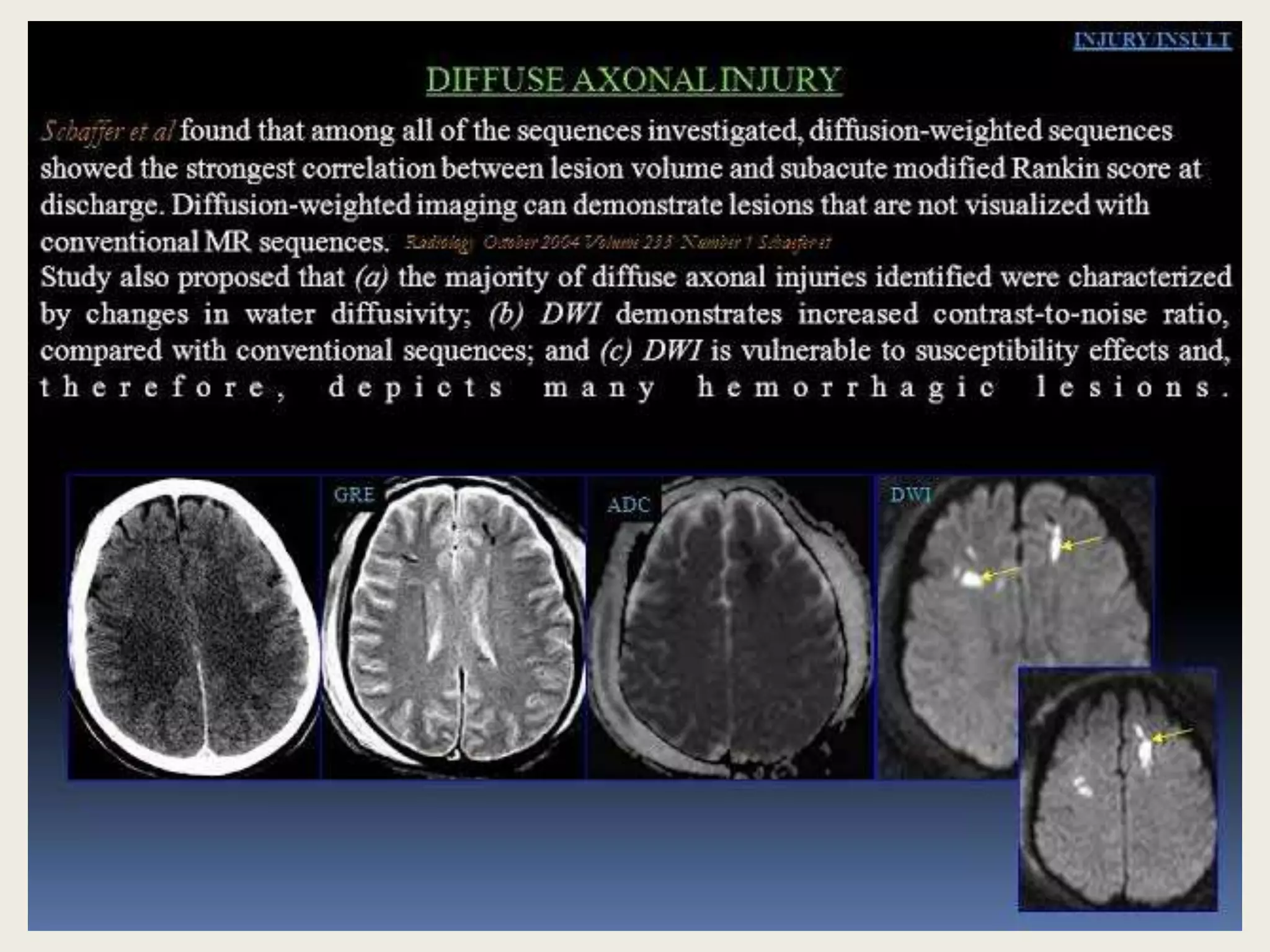Presentation1, radiological application of diffusion weighted imges in ...