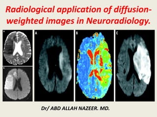 Radiological application of diffusion-
weighted images in Neuroradiology.
Dr/ ABD ALLAH NAZEER. MD.
 