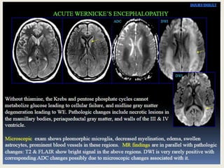 Presentation1, radiological application of diffusion weighted imges in ...
