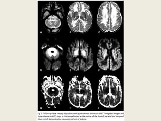 Presentation1, radiological application of diffusion weighted imges in ...