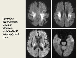 Presentation1, radiological application of diffusion weighted imges in ...
