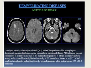 Presentation1, radiological application of diffusion weighted imges in ...