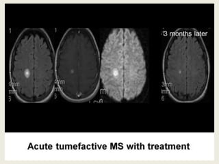 Presentation1, radiological application of diffusion weighted imges in ...