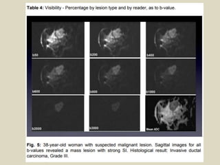 Presentation1, radiological application of diffusion weighted images in ...