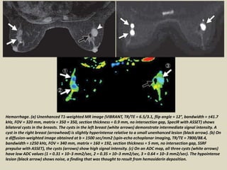 Presentation1, radiological application of diffusion weighted images in ...