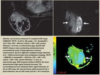 Presentation1, radiological application of diffusion weighted images in ...