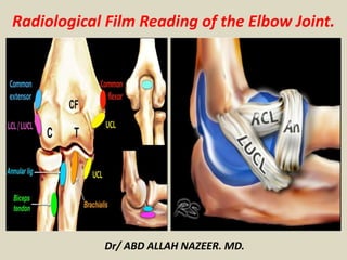 Dr/ ABD ALLAH NAZEER. MD.
Radiological Film Reading of the Elbow Joint.
 
