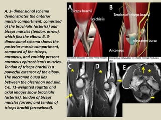 Presentation1, radiological film reading of elbow joint. | PPTX