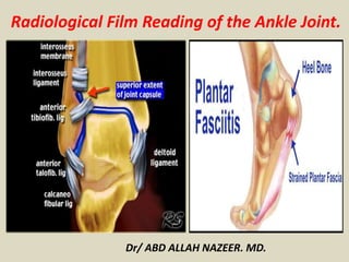Dr/ ABD ALLAH NAZEER. MD.
Radiological Film Reading of the Ankle Joint.
 