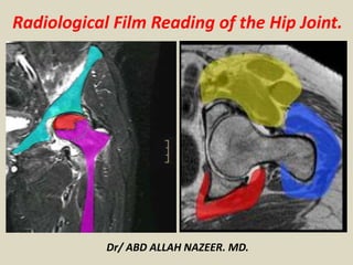 Radiological Film Reading of the Hip Joint.
Dr/ ABD ALLAH NAZEER. MD.
 