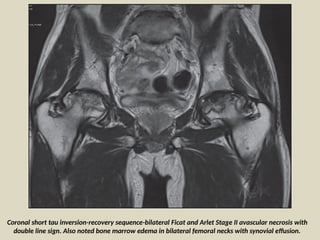 Comprehensive Radiological Analysis of Hip Joint Disorders: Avascular ...