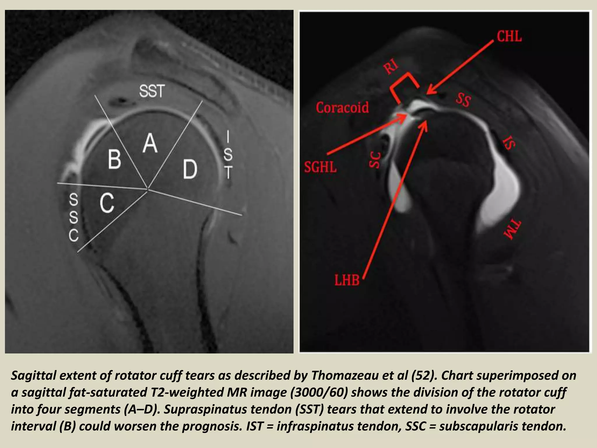 Presentation1, radiological film reading of the sholder joint. | PPT