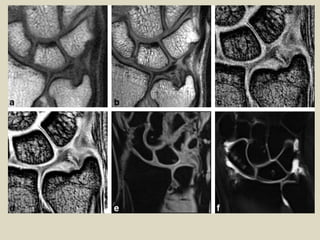 Comprehensive Radiological Film Reading and MRI Protocols for Wrist ...