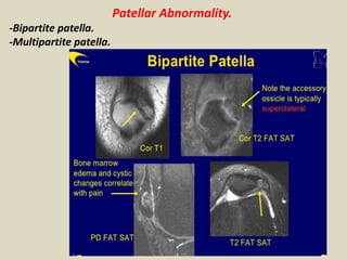 Presentation1, radiological imaging of anterior knee pain. | PPTX