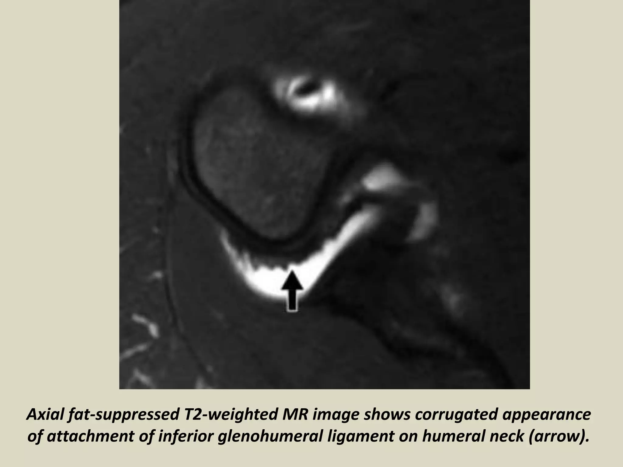 Presentation1, radiological imaging of artifact and pitfalls in ...