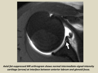 Presentation1, radiological imaging of artifact and pitfalls in ...