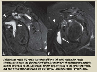 Presentation1, radiological imaging of artifact and pitfalls in ...