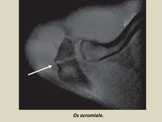 Presentation1, radiological imaging of artifact and pitfalls in ...