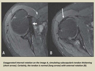 Presentation1, radiological imaging of artifact and pitfalls in ...