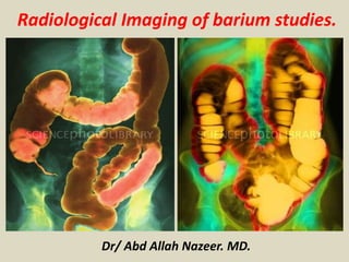 Dr/ Abd Allah Nazeer. MD.
Radiological Imaging of barium studies.
 