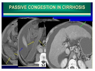 Presentation1, radiological imaging of colitis. | PPTX