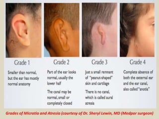 Presentation1, radiological imaging of ear microcia. | PPTX