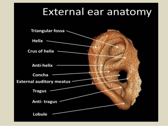 Presentation1, radiological imaging of ear microcia.