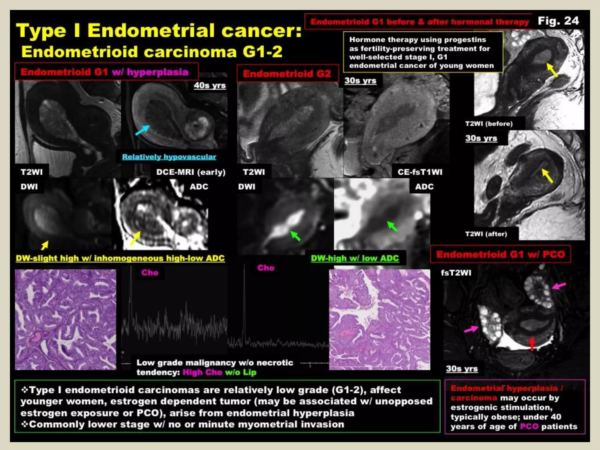 Presentation1, radiological imaging of endometrial carcinoma. | PPTX