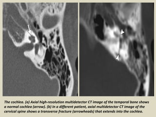 Presentation1, radiological imaging of fractures. | PPTX