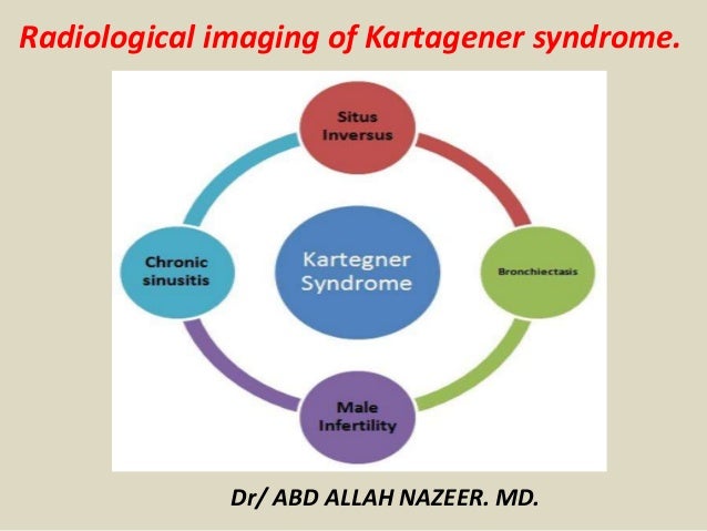 kartagener syndrome infertility Presentation1 Radiological Imaging Of Karrtegner S Syndrome kartagener syndrome infertility