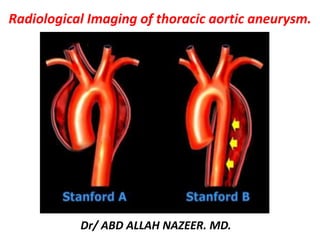 Dr/ ABD ALLAH NAZEER. MD.
Radiological Imaging of thoracic aortic aneurysm.
 