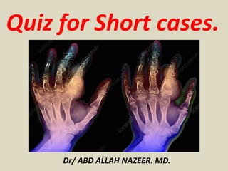 Dr/ ABD ALLAH NAZEER. MD.
Quiz for Short cases.
 
