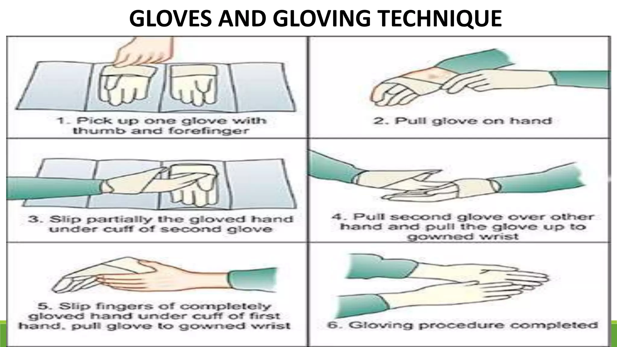 GLOVES AND GLOVING TECHNIQUE
 